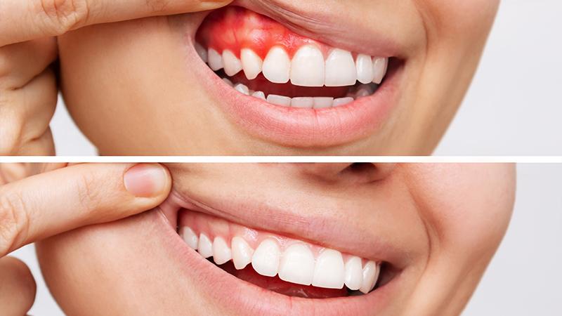 Periodontics/ Implantalogy