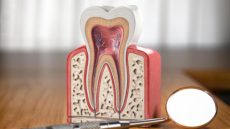 Root Canal Treatments