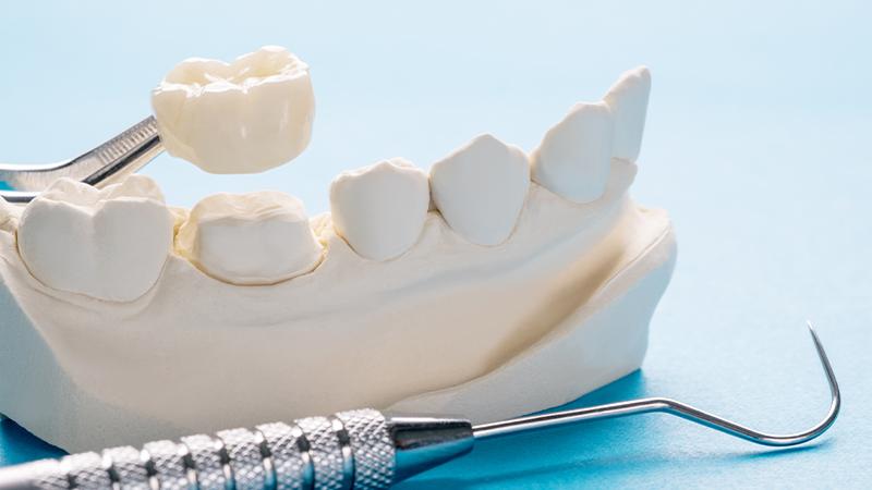 Prosthodontic Treatment