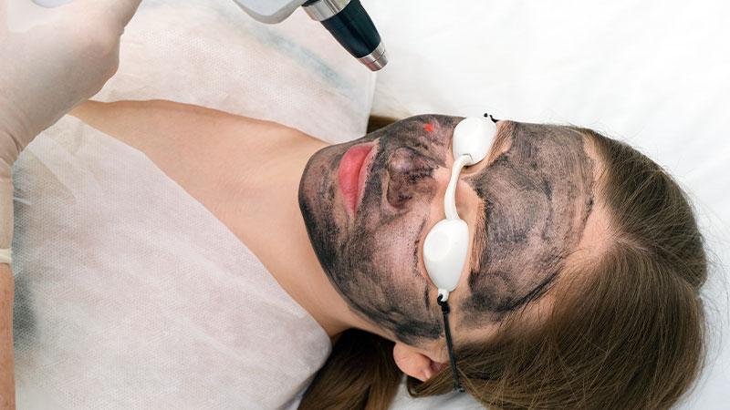 Laser Skin Resurfacing