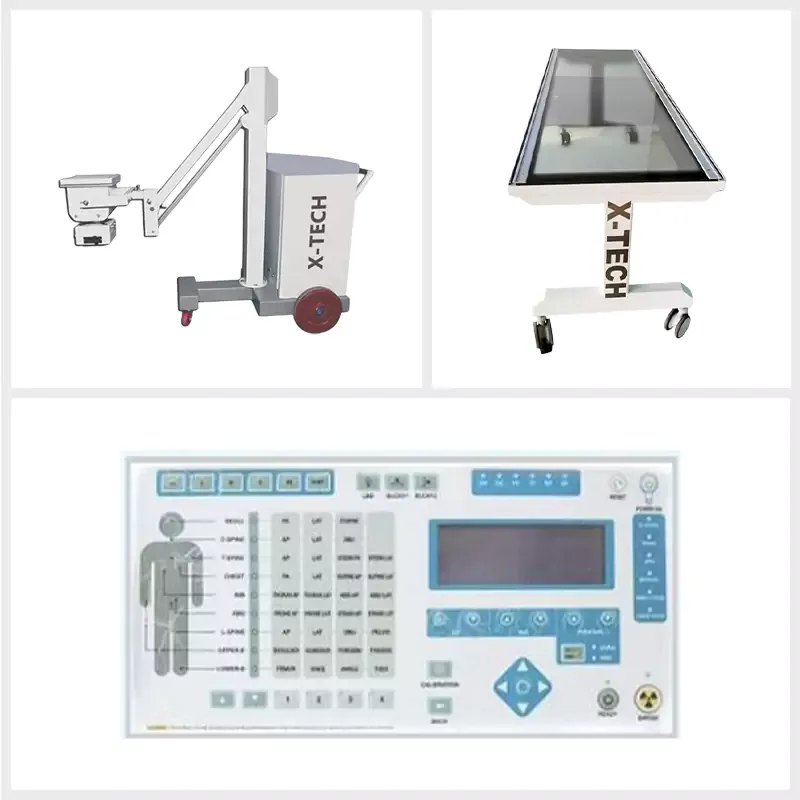 Single Phase High Frequency SBM X-Ray Machine with Transparent Table Top and MOBILEX Table