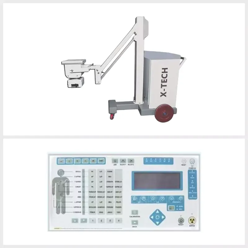 High Frequency Mobile SPRING balance X-Ray Machine