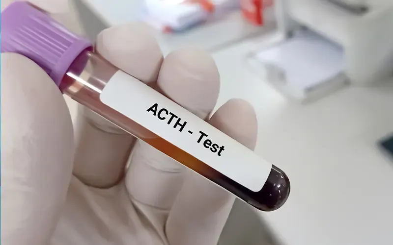 Miscellaneous (HbA1c Test, HPLC Test)