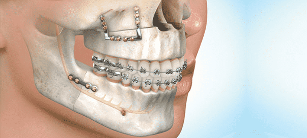 Oral  & Maxillofacial Surgery
