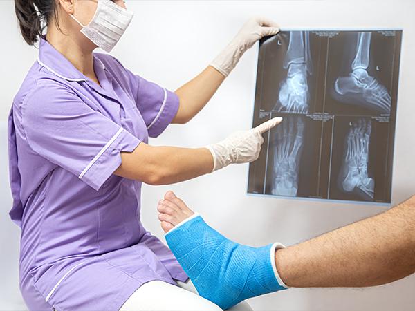  Knee X-ray