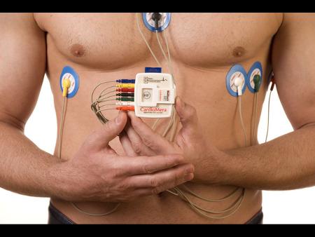 Holter 24 Hrs (digital)