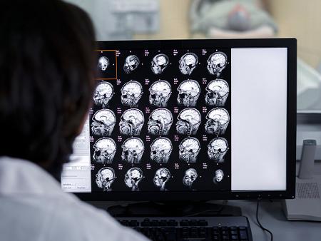 EEG with video image