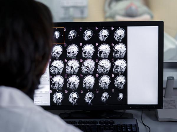 EEG with video image